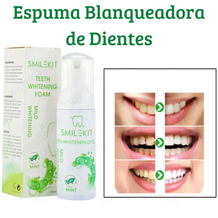 ✨SmileMagic™✨ | Espuma Blanqueadora Dental 🦷💎